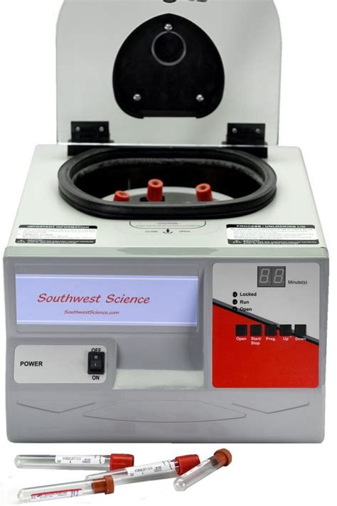 blood centrifuge|blood centrifuge treatment.